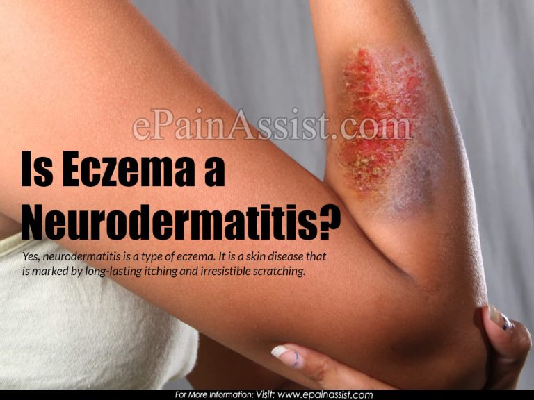 Is Eczema a Neurodermatitis?