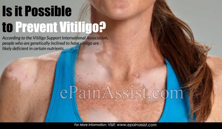 Is it Possible to Prevent Vitiligo?
