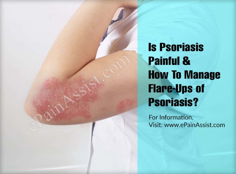 Is Psoriasis Painful & How To Manage Flare-Ups of Psoriasis?