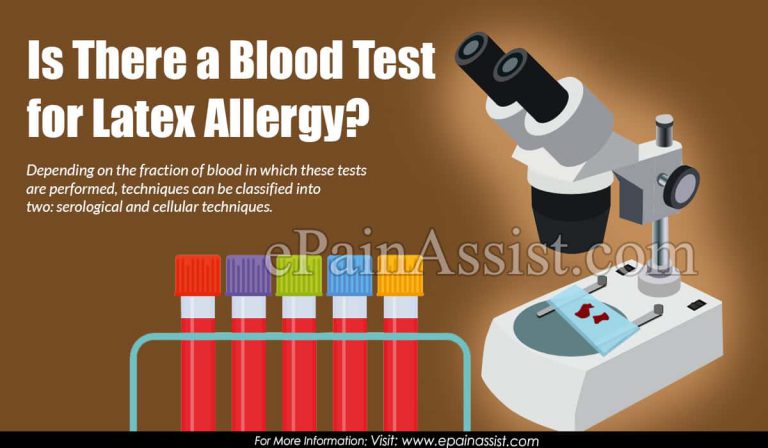 Is There a Blood Test for Latex Allergy?