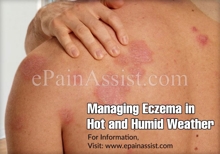 Weather & Eczema Flare-Ups: Managing Severe Eczema in Extreme Temperatures