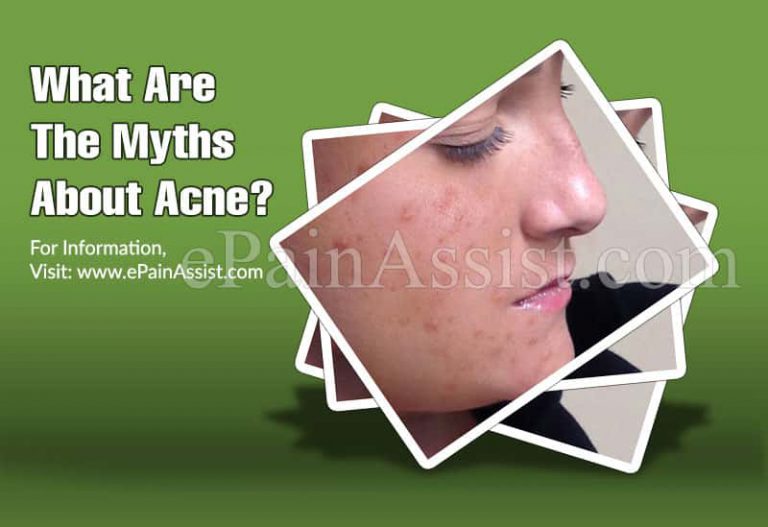 Myths About Acne & Some Effective Ways To Control It