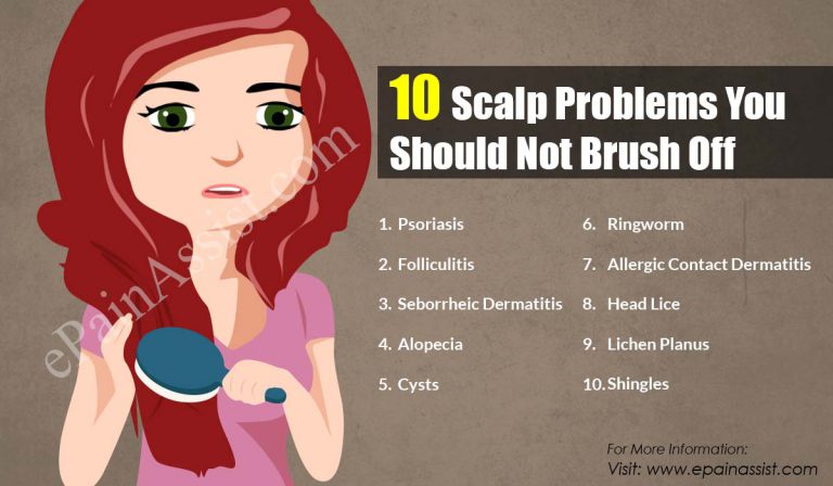 10 Scalp Problems You Should Not Brush Off