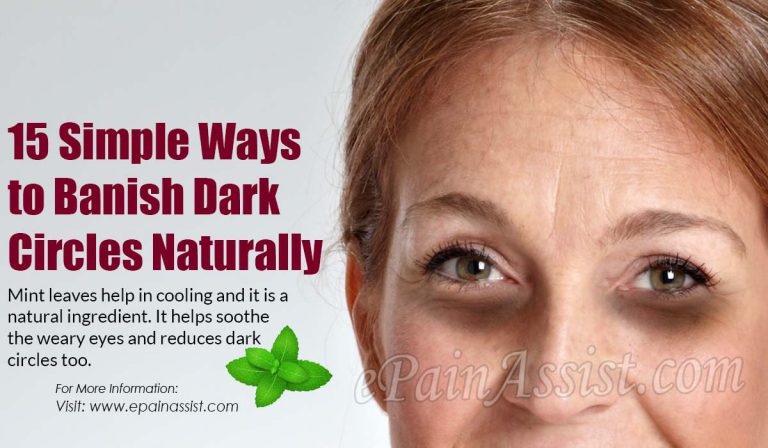 15 Simple Ways to Banish Dark Circles Naturally