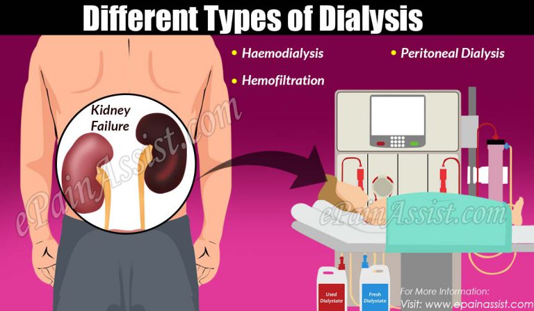 Different Types of Dialysis & its Advantages and Disadvantages