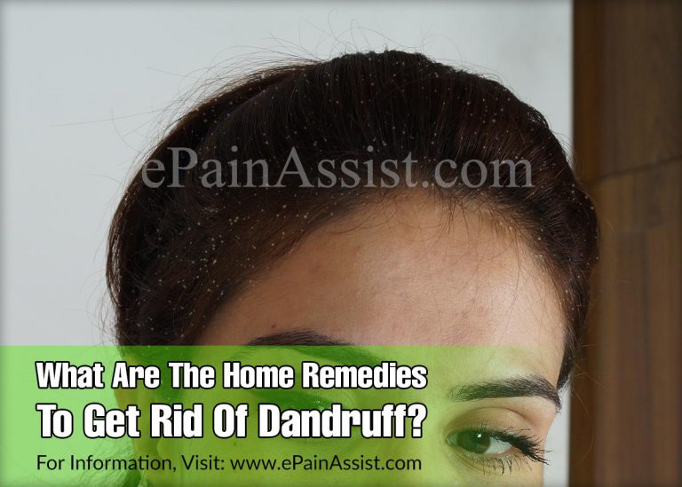 What Are The Home Remedies To Get Rid Of Dandruff?