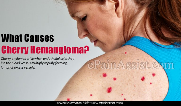 What Causes Cherry Hemangioma?