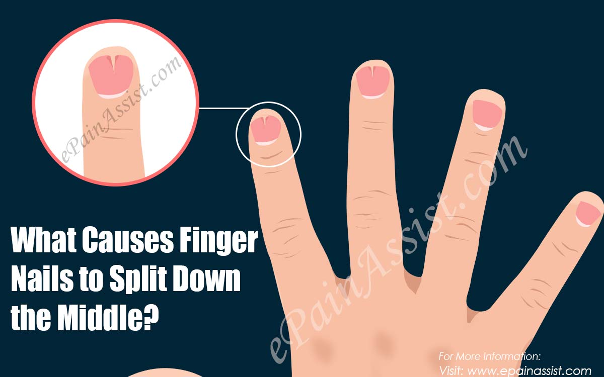 What Causes Finger Nails to Split Down the Middle?