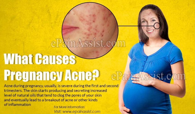 What Causes Pregnancy Acne & How to Deal with Acne During Pregnancy?