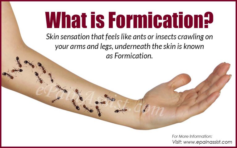 Formication: What Causes Crawling Ant Sensation in Arms & Legs?