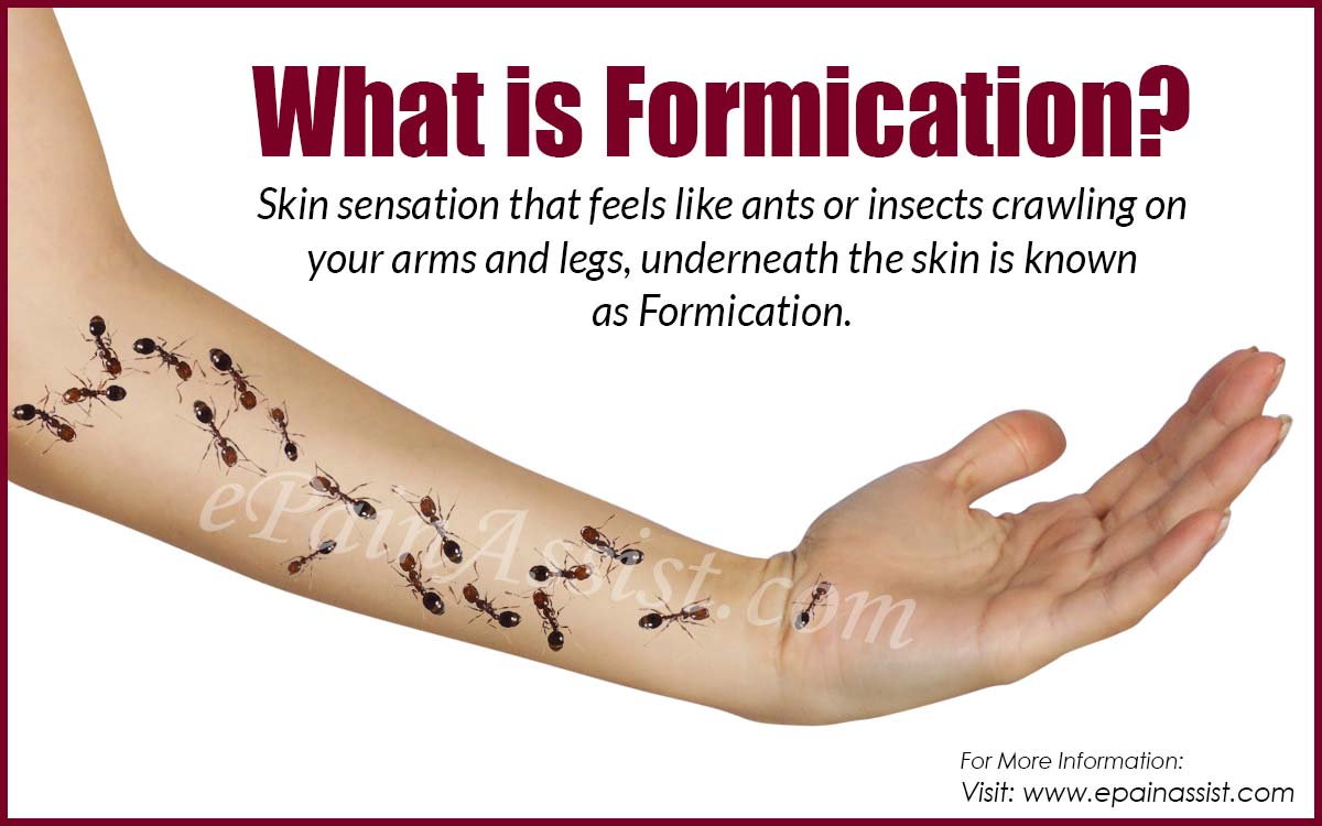 What is Formication or the Crawling Ant Sensation in Arms and Legs?