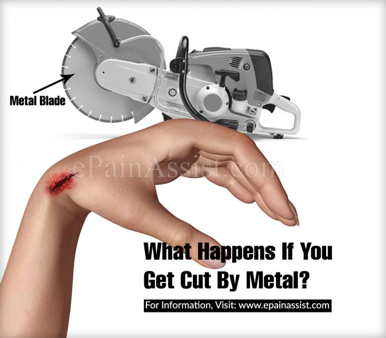 What Happens If You Get Cut By Metal?
