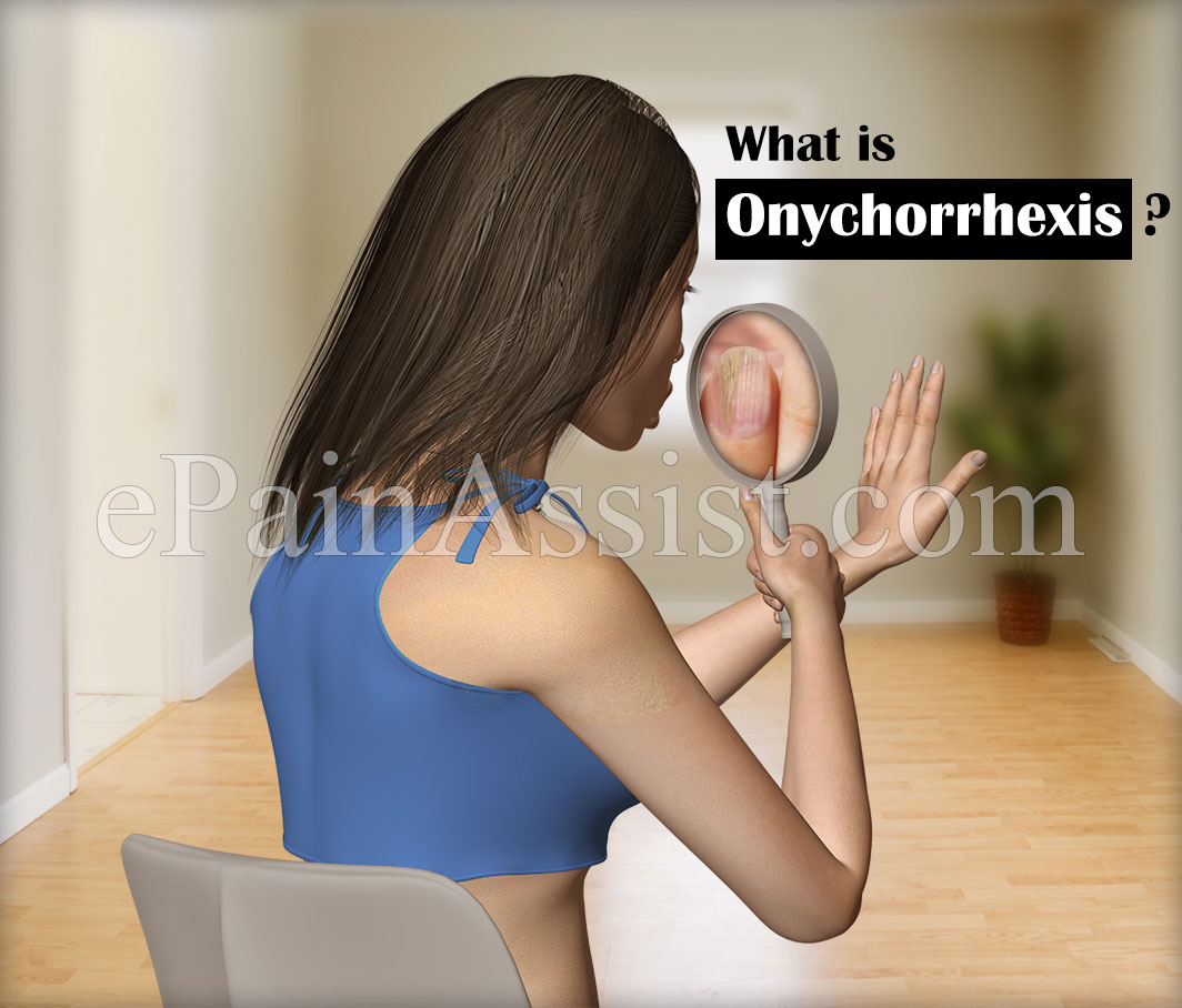 What is Onychorrhexis?