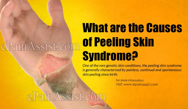What is Peeling Skin Syndrome: Causes, Symptoms, Treatment, Diagnosis