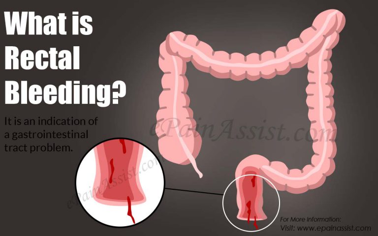What is Rectum Infection & Bleeding & How is it Treated?