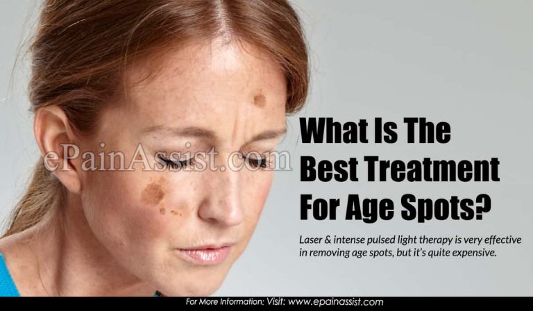 What Is The Best Treatment For Age Spots?