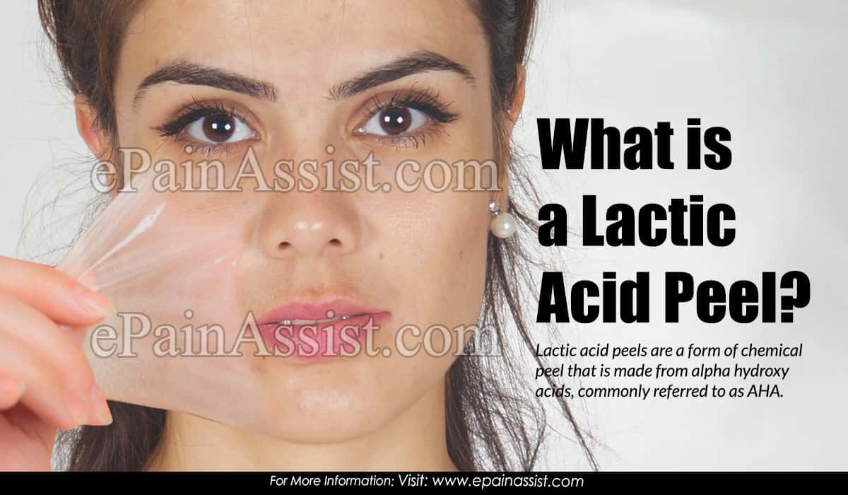 What is a Lactic Acid Peel?