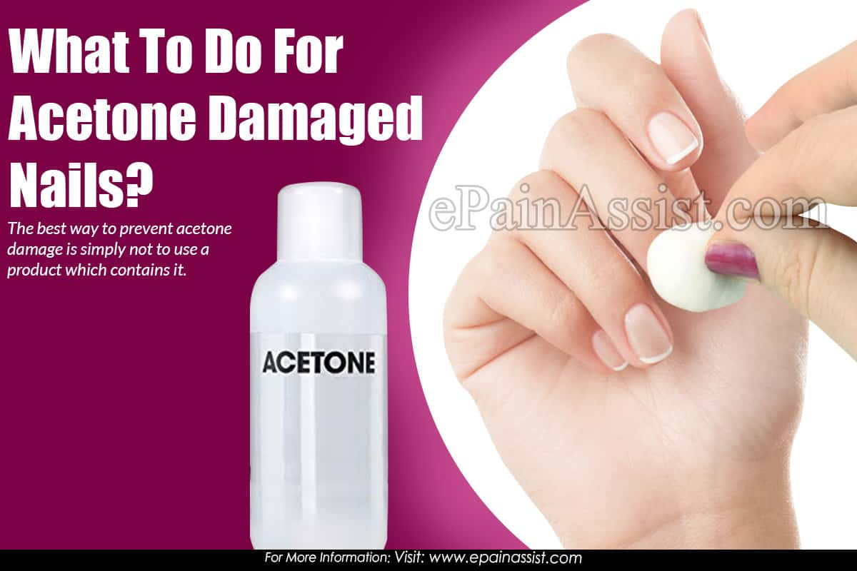 What To Do For Acetone Damaged Nails?