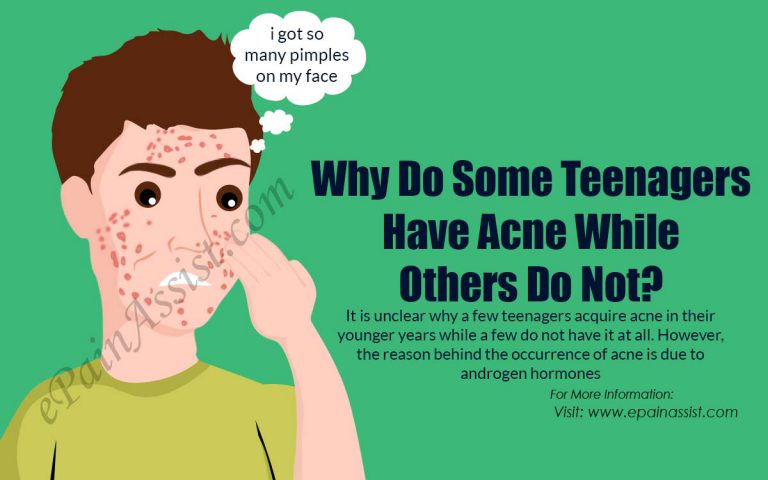 What is the Best Treatment for Teenage Acne?