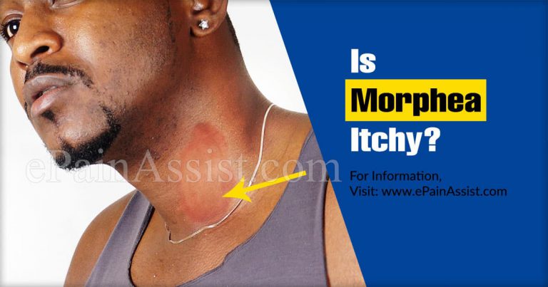 Is Morphea Itchy & What Age Group Is More Likely To Suffer From Morphea?