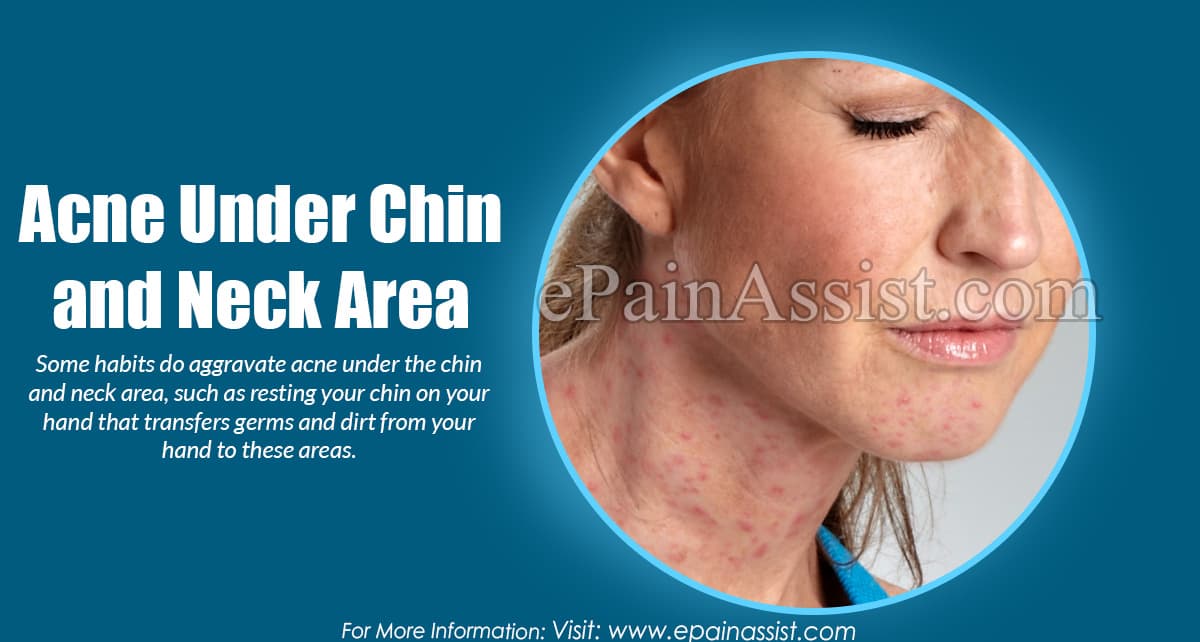 Acne Under Chin and Neck Area: Causes, Treatment, Prevention