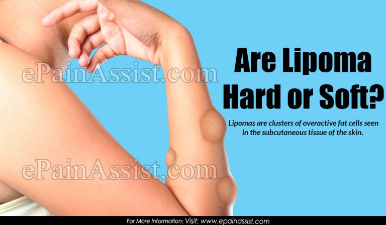 Are Lipomas Hard or Soft?