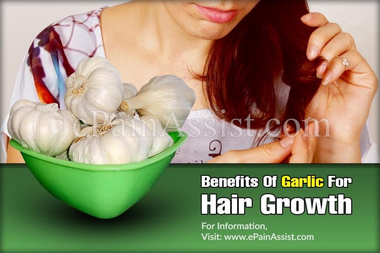 Benefits Of Garlic For Hair Growth & How To Use It?