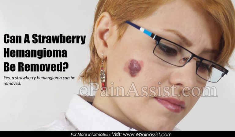 Can A Strawberry Hemangioma Be Removed?