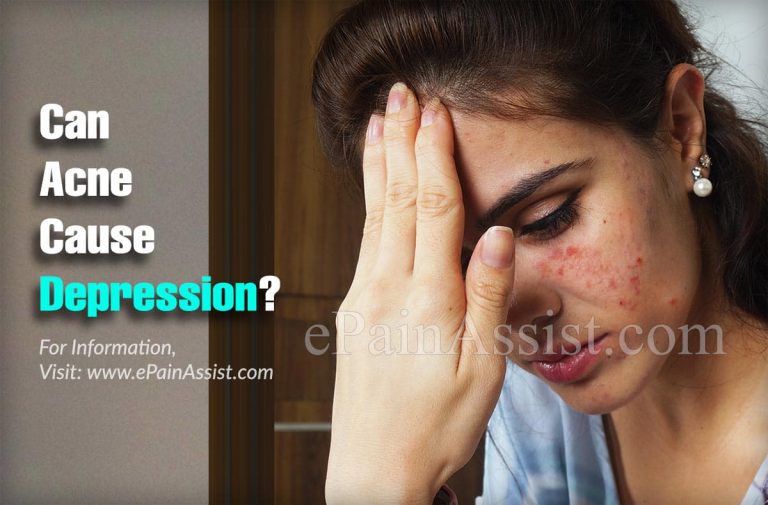 Can Acne Cause Depression?