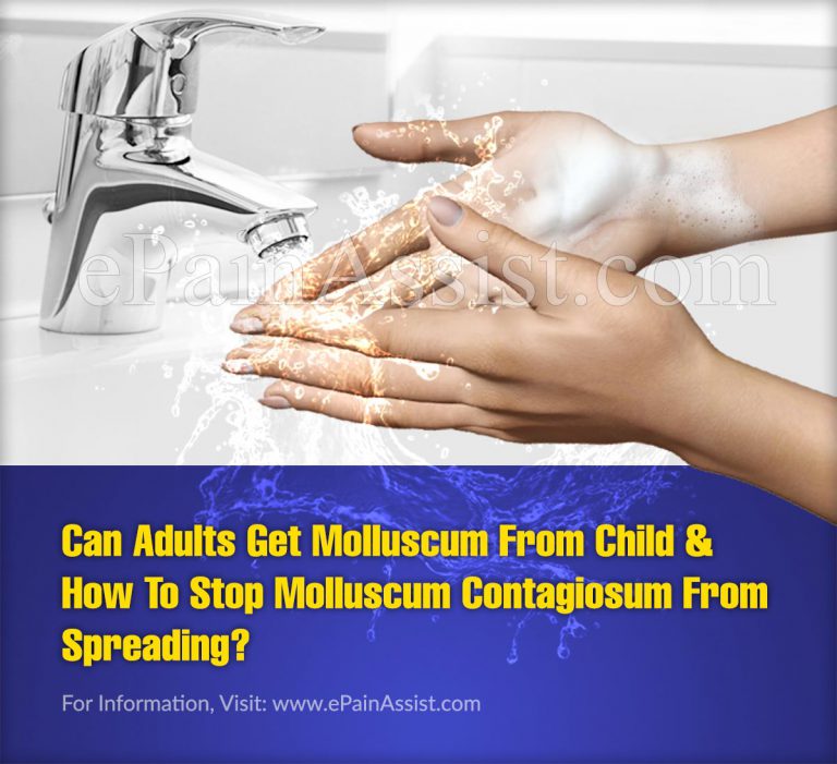 Can Adults Get Molluscum From Child & How To Stop Molluscum Contagiosum From Spreading?