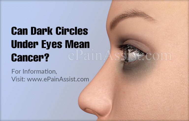 Can Dark Circles Under Eyes Mean Cancer?