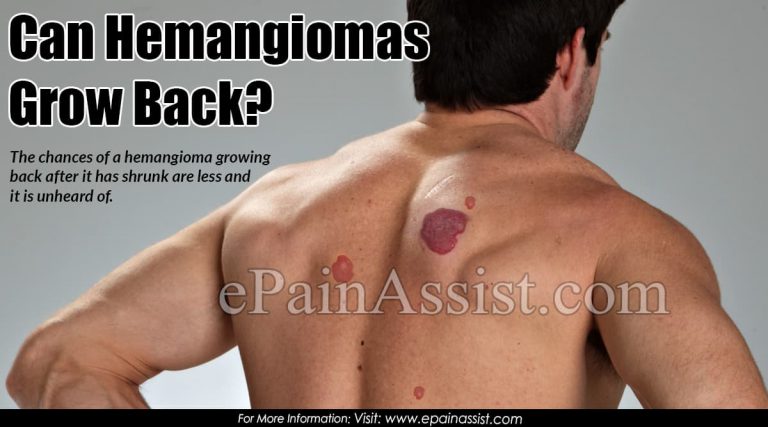 Can Hemangiomas Grow Back?