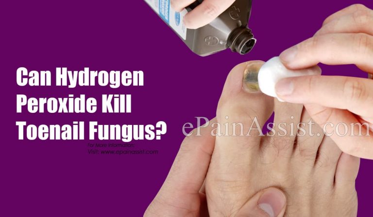 Can Hydrogen Peroxide Kill Toenail Fungus? How About Listerine?