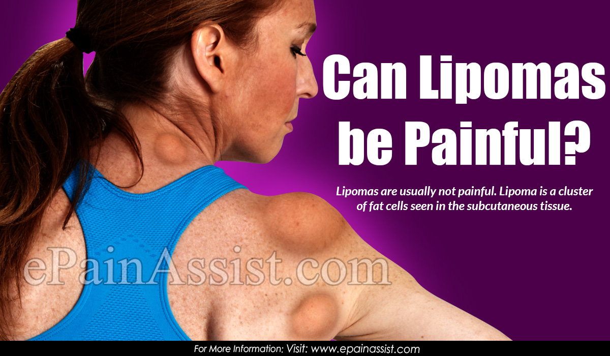 Can Lipomas Be Painful?