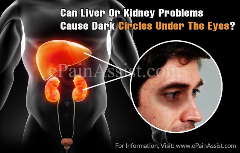 Can Liver Or Kidney Problems Cause Dark Circles Under The Eyes?