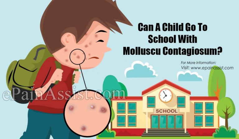 Can My Child Go To School With Molluscum Contagiosum?