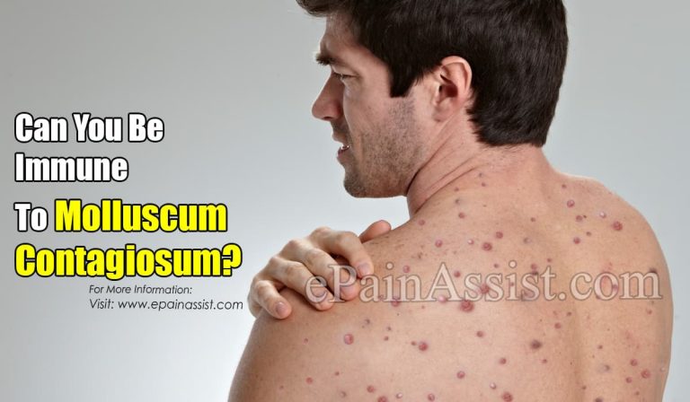 Can You Be Immune To Molluscum Contagiosum?