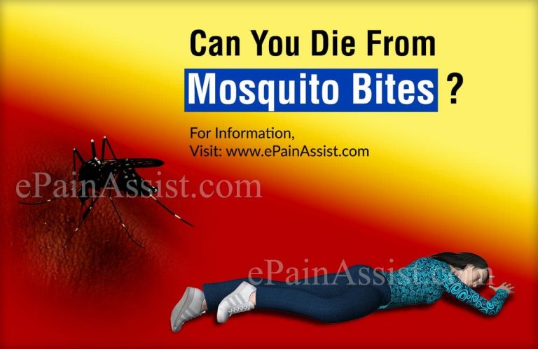 Can You Die From Mosquito Bites?