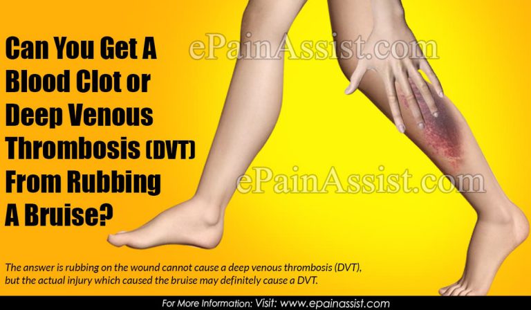 Can You Get A Blood Clot or Deep Venous Thrombosis (DVT) From Rubbing A Bruise?