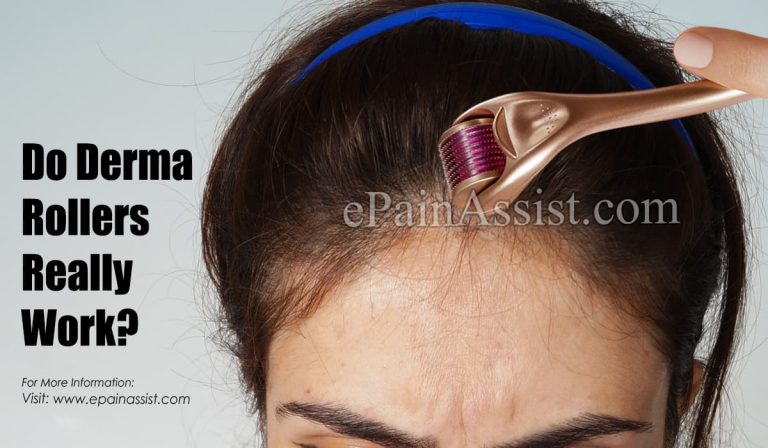 Do Derma Rollers Really Work & Which Derma Roller Size Is Best?