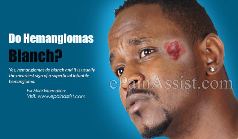 Do Hemangiomas Blanch?