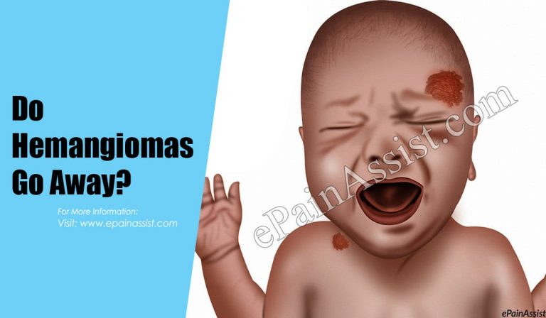 Do Hemangiomas Go Away?