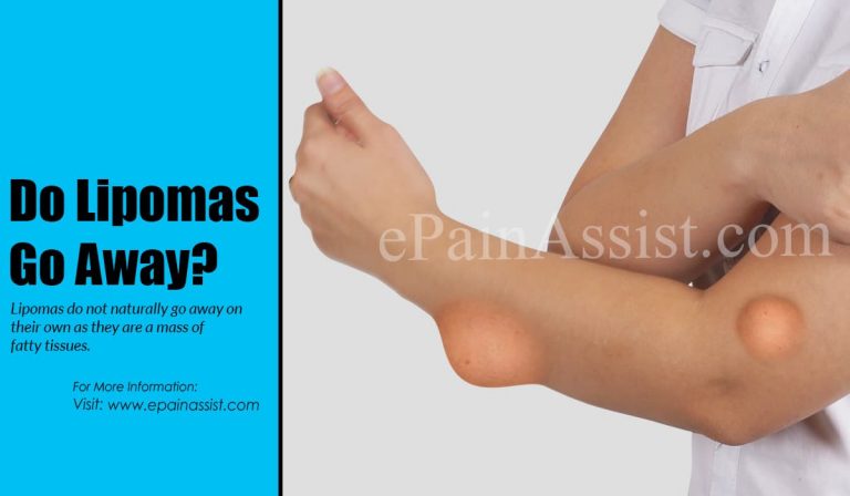 Do Lipomas Go Away?