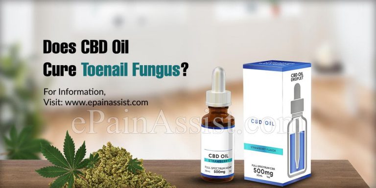 Does CBD Oil Cure Toenail Fungus?