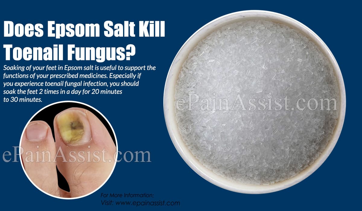 Does Epsom Salt Kill Toenail Fungus