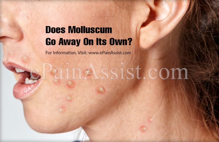 Does Molluscum Go Away On Its Own?