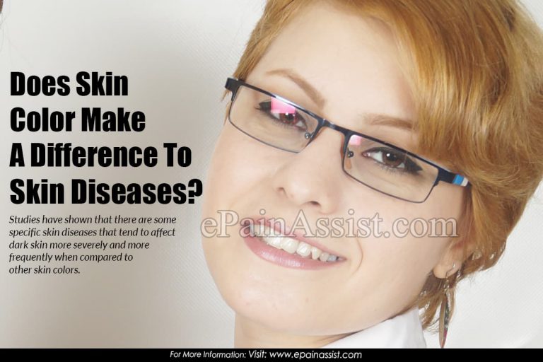 Does Skin Color Make A Difference To Skin Diseases?