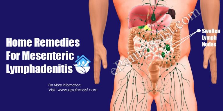 Home Remedies For Mesenteric Lymphadenitis