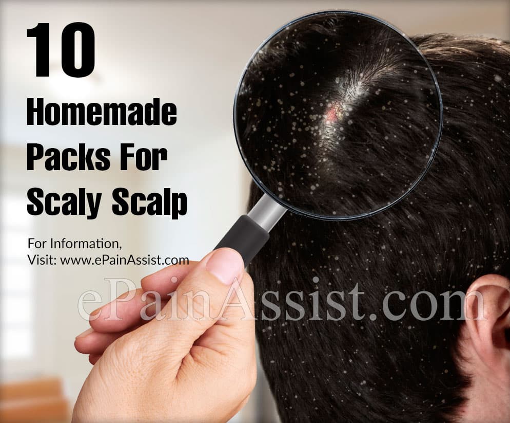 10 Homemade Packs For Scaly Scalp