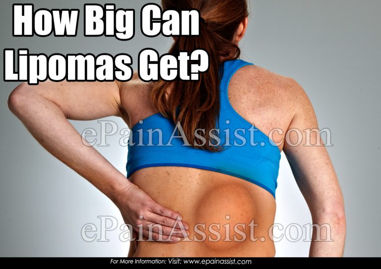 How Big Can Lipomas Get?